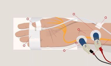 Neuromuscular Monitoring Course ed_20260621