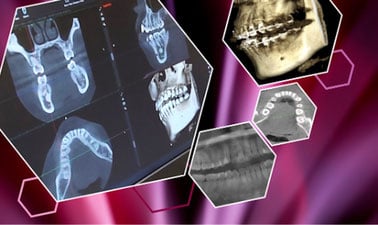 Anatomy and Pathology in Dento-MaxilloFacial Radiology (DMFR) - The Art and Science of Good Reporting ed_20260625